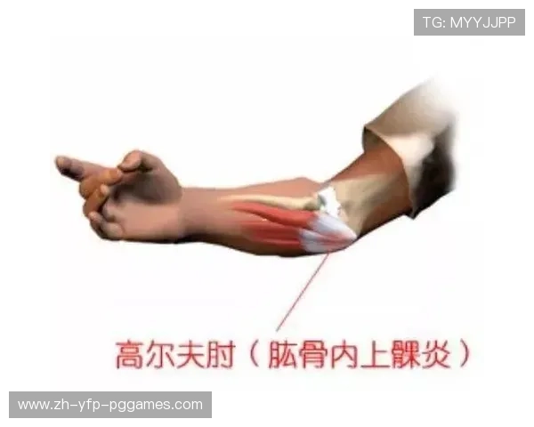 羽毛球肘炎治疗